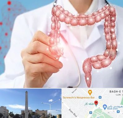 جراح سرطان روده بزرگ در فلکه گاز شیراز 