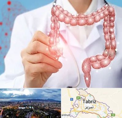 جراح سرطان روده بزرگ در تبریز