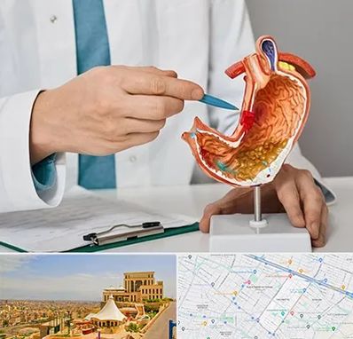 دکتر سرطان معده در هاشمیه مشهد 