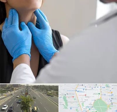 دکتر سرطان گلو در منطقه 17 تهران 