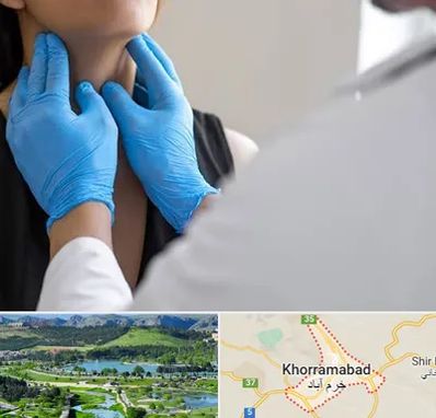 دکتر سرطان گلو در خرم آباد
