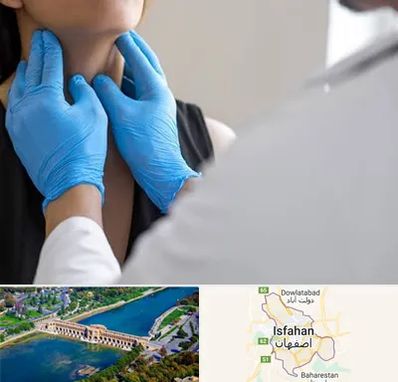 دکتر سرطان گلو در اصفهان