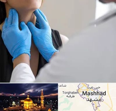 دکتر سرطان گلو در مشهد