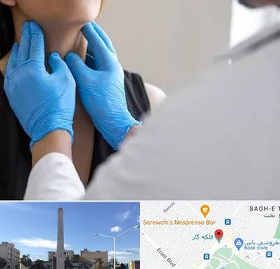 دکتر سرطان گلو در فلکه گاز شیراز 