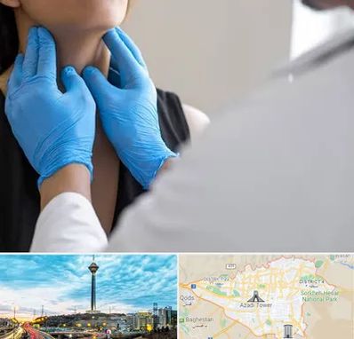 دکتر سرطان گلو در تهران