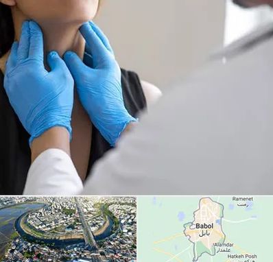 دکتر سرطان گلو در بابل