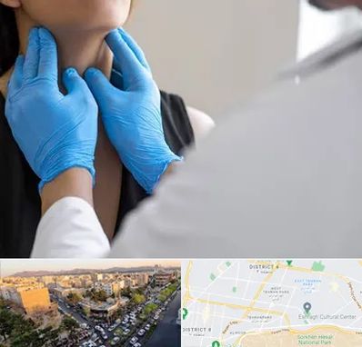 دکتر سرطان گلو در تهرانپارس 