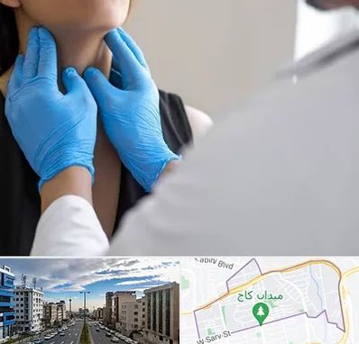 دکتر سرطان گلو در سعادت آباد 
