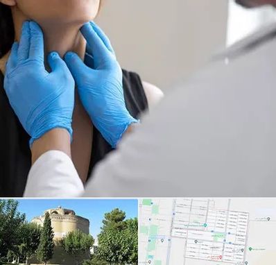 دکتر سرطان گلو در مرداویج اصفهان 