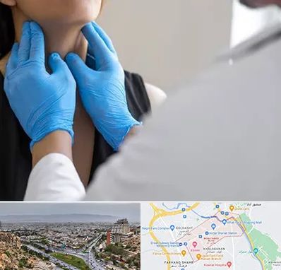 دکتر سرطان گلو در معالی آباد شیراز 