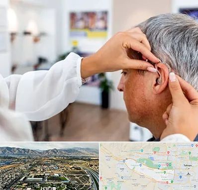 دکتر کم شنوایی در منطقه 21 تهران 