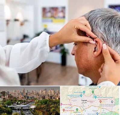 دکتر کم شنوایی در منطقه 1 تهران 