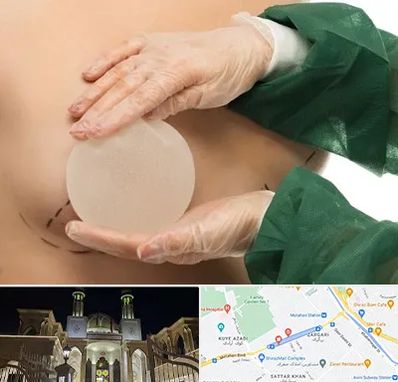 جراحی پروتز سینه در زرگری شیراز