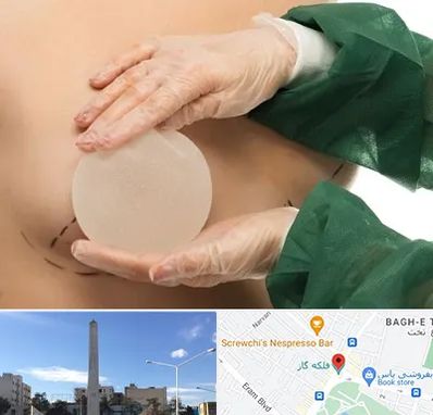 جراحی پروتز سینه در فلکه گاز شیراز
