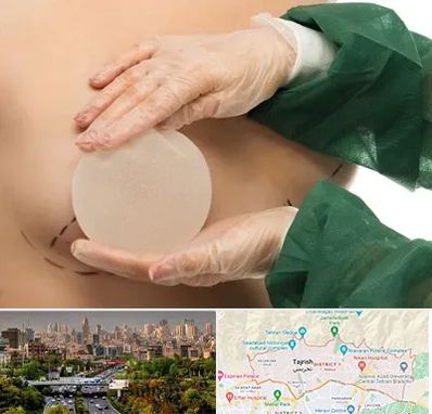 جراحی پروتز سینه در منطقه 1 تهران
