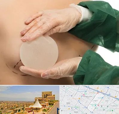 جراحی پروتز سینه در هاشمیه مشهد
