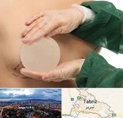 جراحی پروتز سینه در تبریز