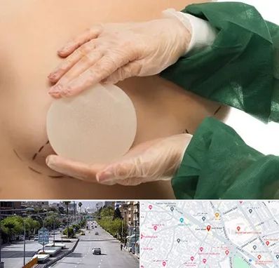 جراحی پروتز سینه در خیابان زند شیراز