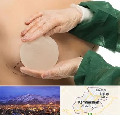 جراحی پروتز سینه در کرمانشاه