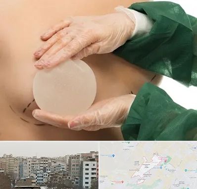 جراحی پروتز سینه در محمد شهر کرج