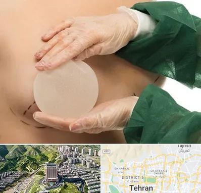 جراحی پروتز سینه در شمال تهران