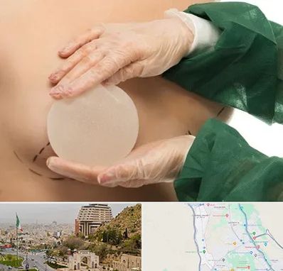 جراحی پروتز سینه در فرهنگ شهر شیراز
