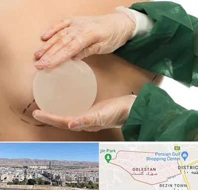 جراحی پروتز سینه در شهرک گلستان شیراز