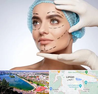 جراحی زیبایی در لاهیجان
