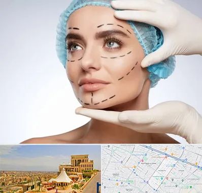 جراحی زیبایی در هاشمیه مشهد