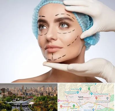 جراحی زیبایی در منطقه 1 تهران