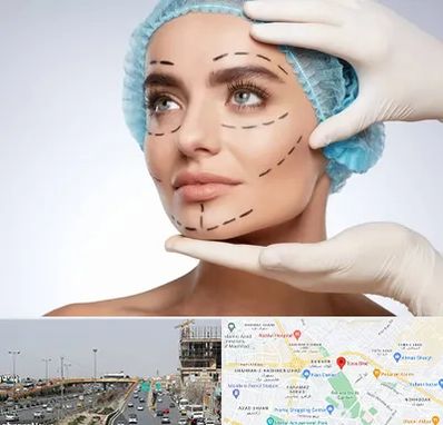 جراحی زیبایی در بلوار توس مشهد