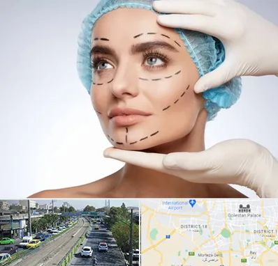 جراحی زیبایی در جنوب تهران