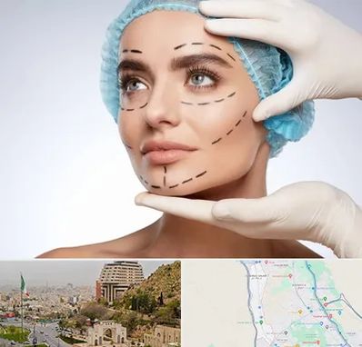 جراحی زیبایی در فرهنگ شهر شیراز