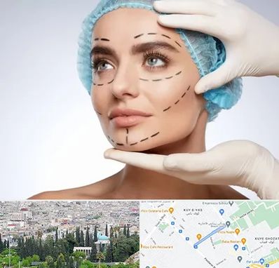 جراحی زیبایی در محلاتی شیراز