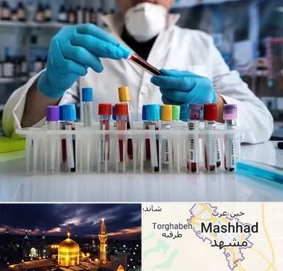 آزمایشگاه خون در مشهد