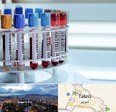 آزمایشگاه ژنتیک در تبریز