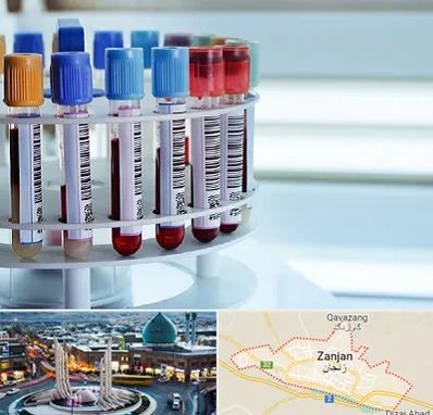آزمایشگاه ژنتیک در زنجان