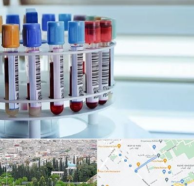 آزمایشگاه ژنتیک در محلاتی شیراز