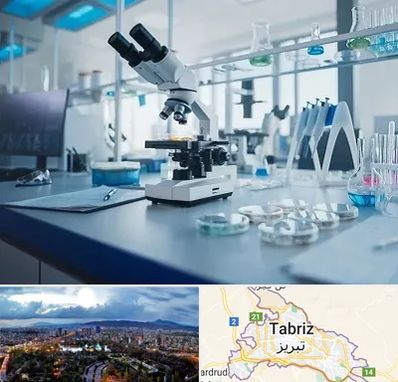 آزمایشگاه تیروئید در تبریز