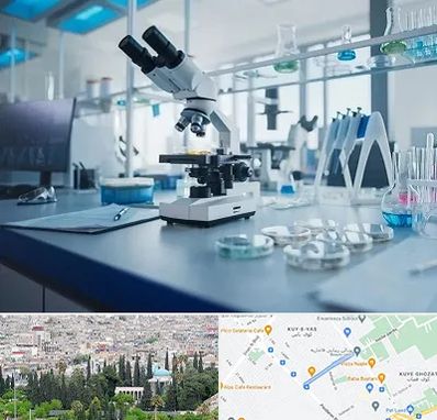 آزمایشگاه تیروئید در محلاتی شیراز