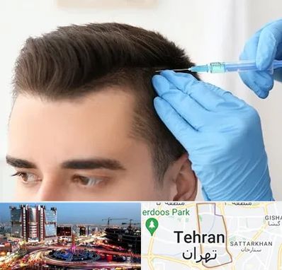 مزوتراپی مو در صادقیه