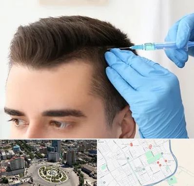 مزوتراپی مو در زرافشان اسلامشهر