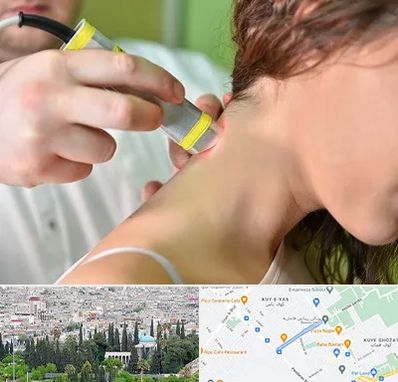 لیزر درمانی در محلاتی شیراز