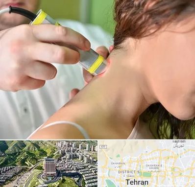 لیزر درمانی در شمال تهران