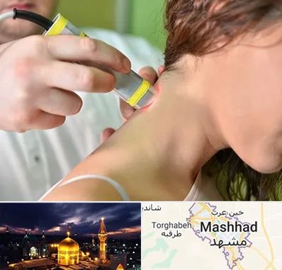 لیزر درمانی در مشهد