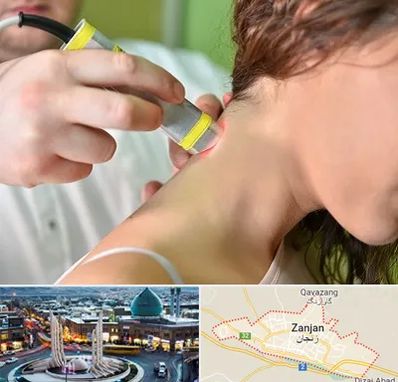 لیزر درمانی در زنجان