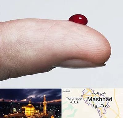 مرکز فصد خون در مشهد