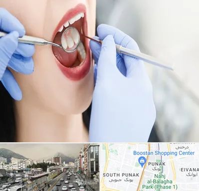 جراح دندان عقل در پونک 