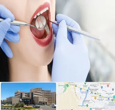 جراح دندان عقل در صیاد شیرازی مشهد