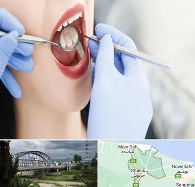 جراح دندان عقل در چالوس